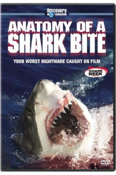 Anatomy of a Shark Bite